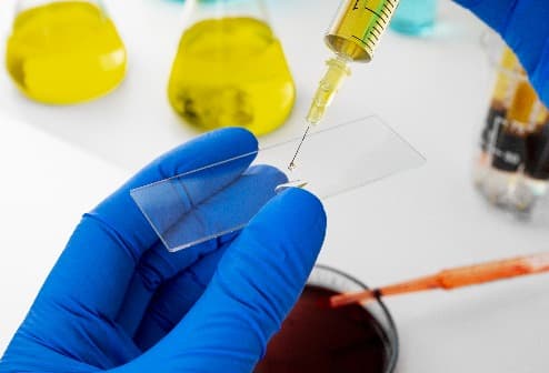 Stem Cell Therapy