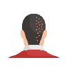 Hairline Design & Aesthetics